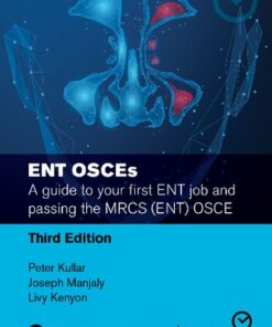 ENT OSCEs: A guide to your first ENT job and passing the MRCS ENT OSCE (2022)